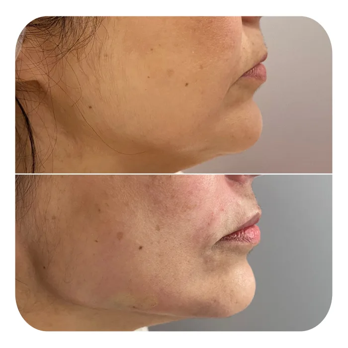 bionutri lift (3)