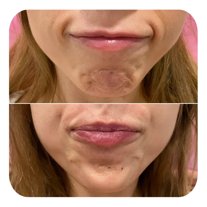 deniro chin (2)