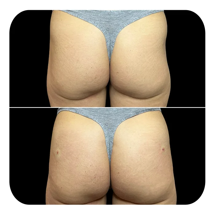 hip dip (1)