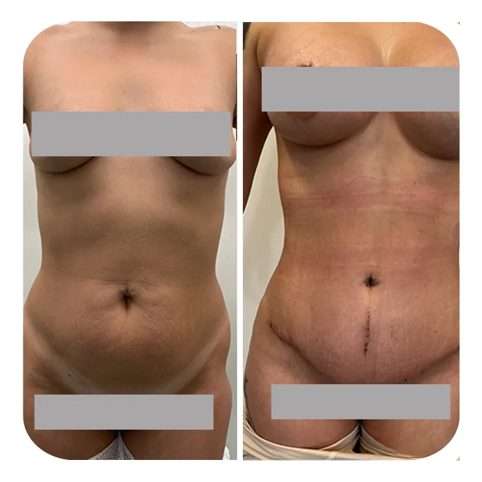 MommyMakeOver_2