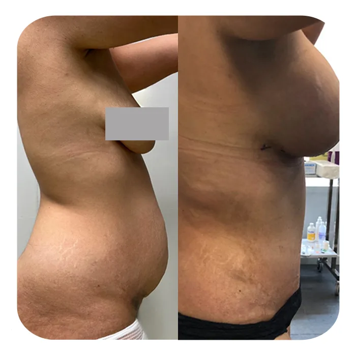 MommyMakeOver_3