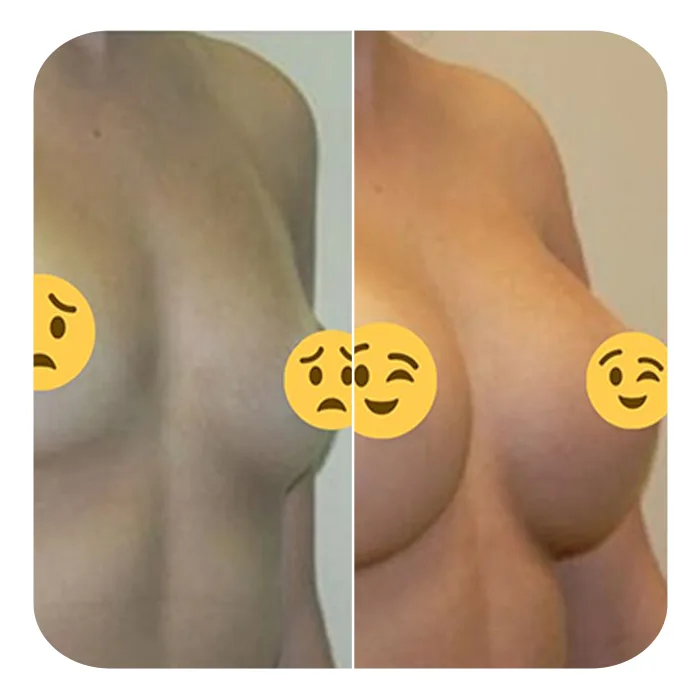 afksitiki 4