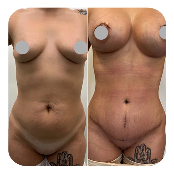 koilia 24